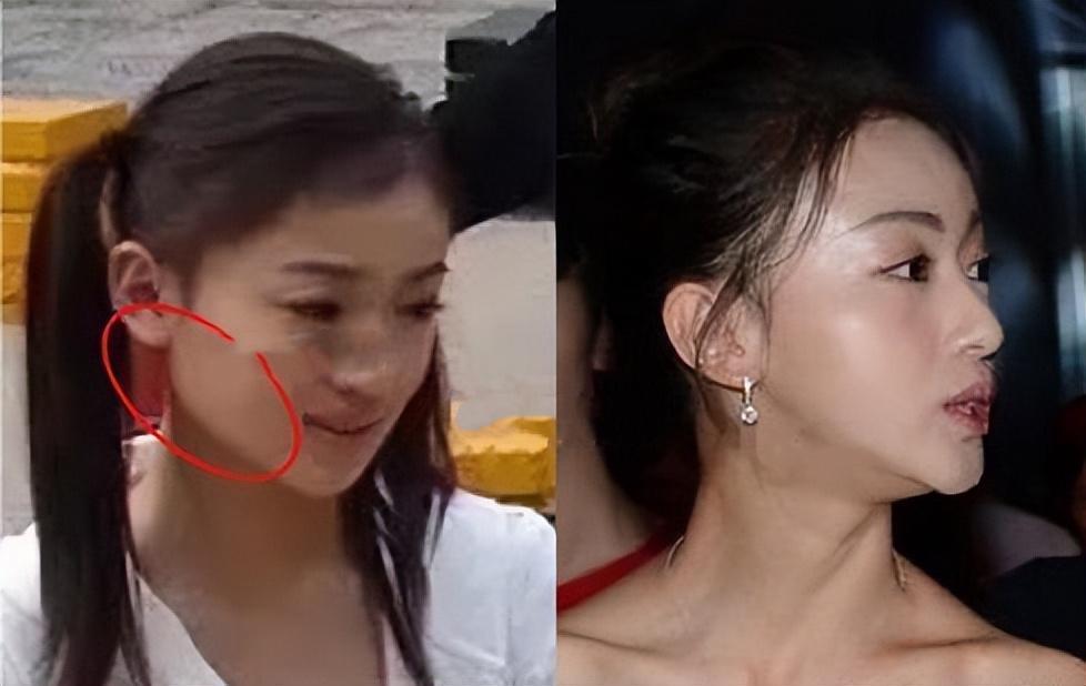 娱乐圈的整容脸,为什么娱乐圈那么多整容脸