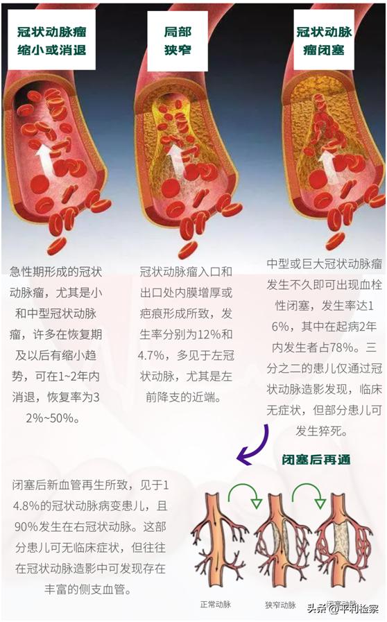 反复发烧咳嗽是什么病的前兆吗,高烧咳嗽胸痛是什么病