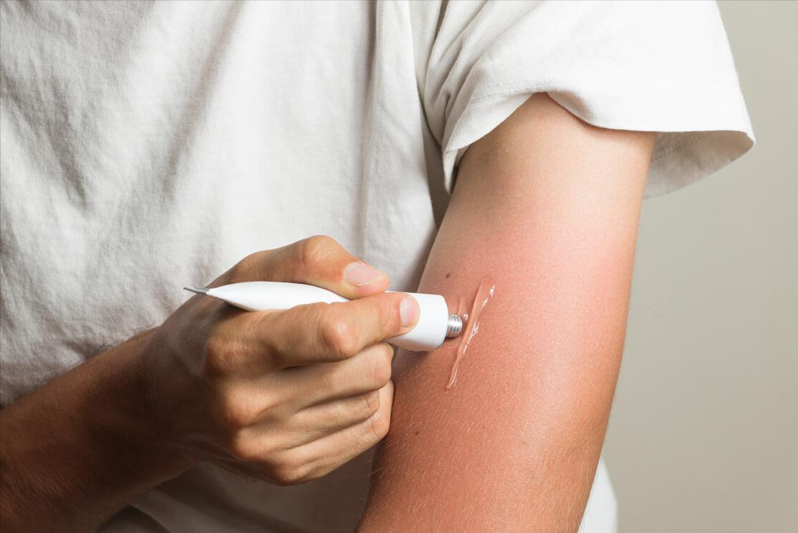 几块钱的红霉素软膏竟能治6种病,红霉素软膏贵的和便宜的区别大吗