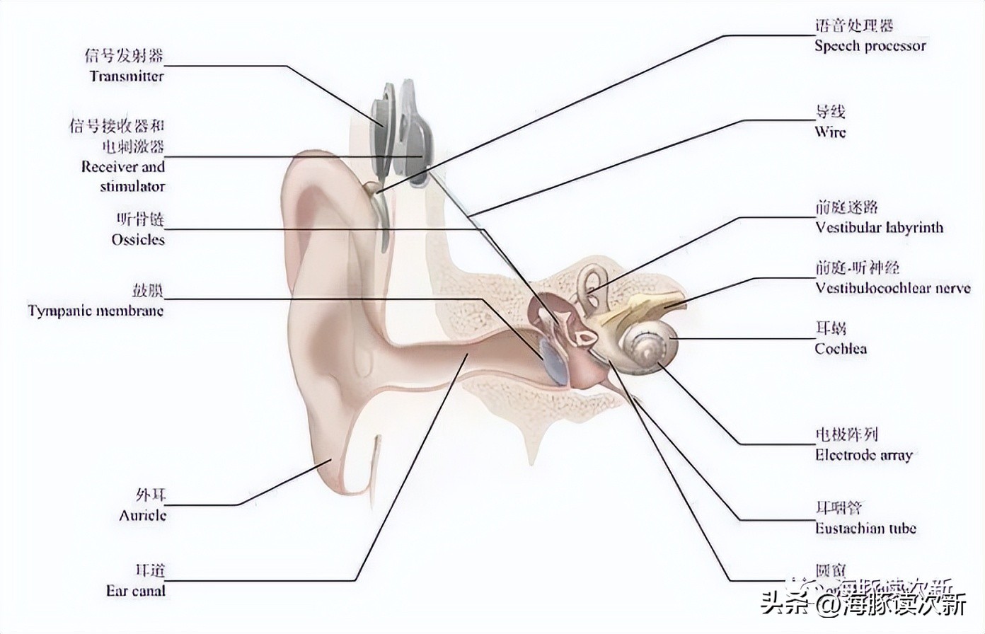 为全球巨头提供呼吸机+人工耳蜗核心组件，暴涨后能否持续美好？