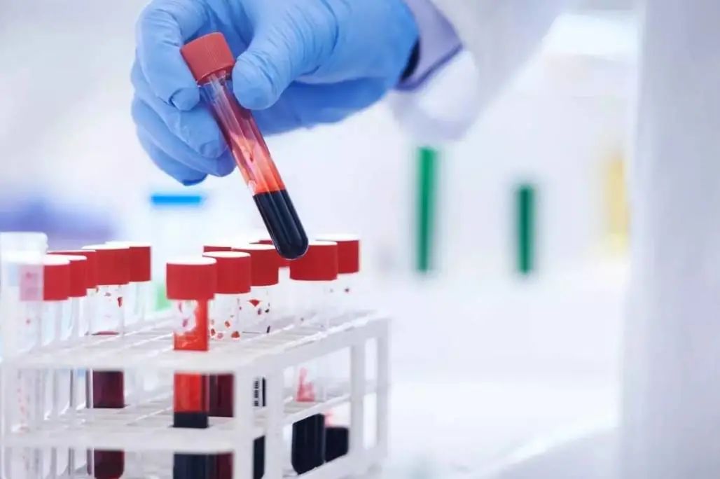 专家解读为什么儿童白血病高发,白血病治疗好了还会复发吗