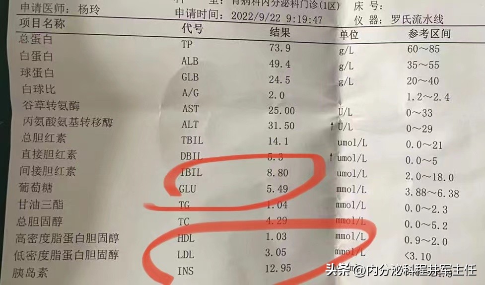 二型糖尿病控制血糖最好的方法,它被称为糖尿病的克星