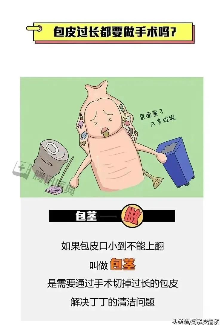 割完包皮后要恢复多久,割完包皮之后要多久恢复