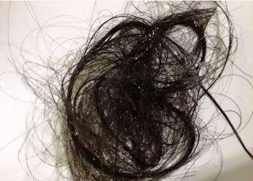 生发液推荐平价学生中性发质,适合头发天生少的生发液真实测评