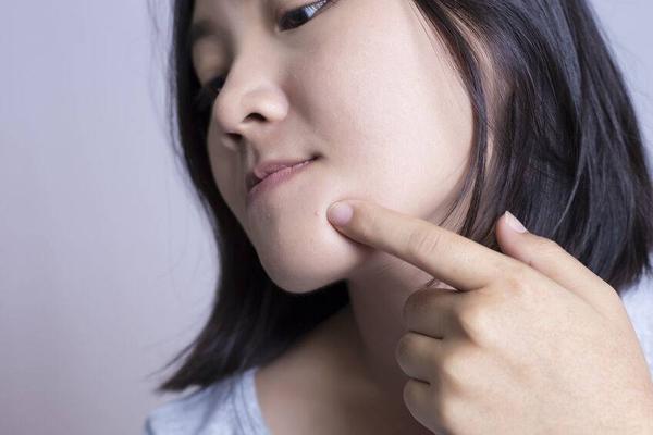 脸上长痘痘了怎么办最简单的方法,脸上长痘痘怎么办最简单的方法