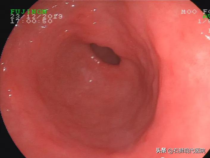 有哪些人不合适做胃镜,石狮市医院做胃镜肠镜技术可以吗