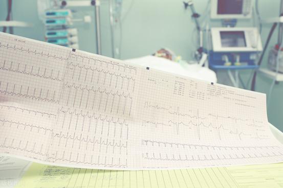 几种常见的心律失常的症状表现,心律失常有什么症状及治疗方法