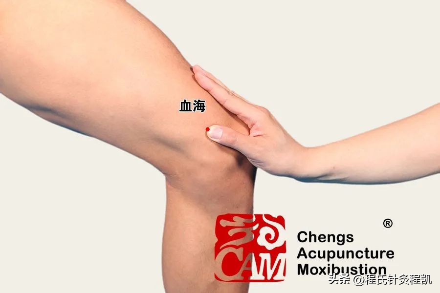 程凯养生说专栏荨麻疹,程凯养生说手麻原因