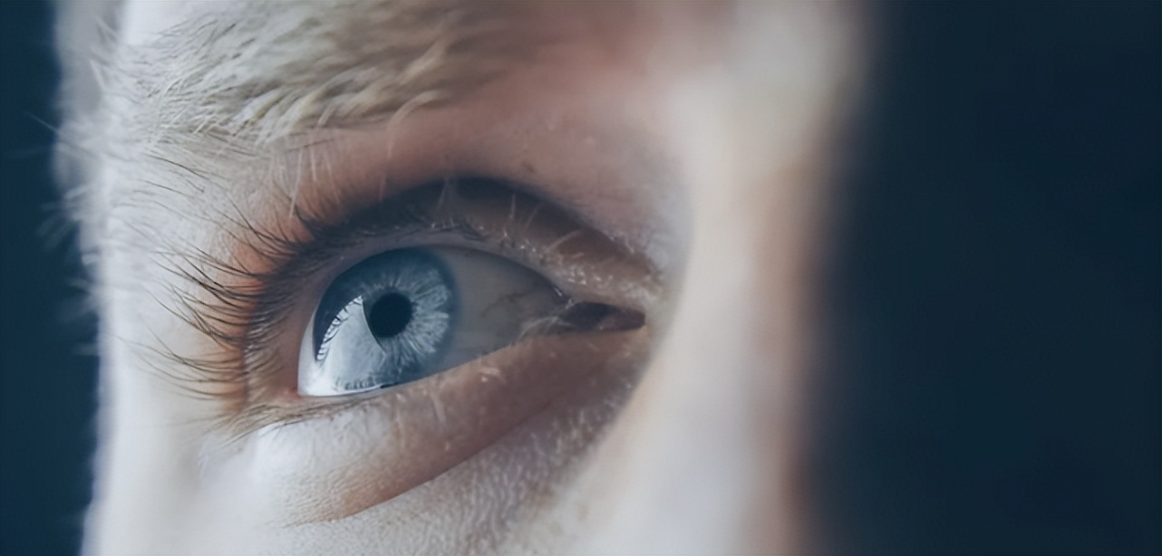 阳了以后眼睛不舒服,阳过后眼睛看东西模糊