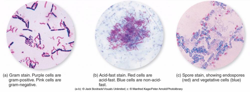 革兰氏染色原理及操作方法,革兰氏染色的原理和方法