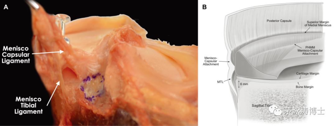 半月板损伤常见100个问题,半月板损伤原因视频