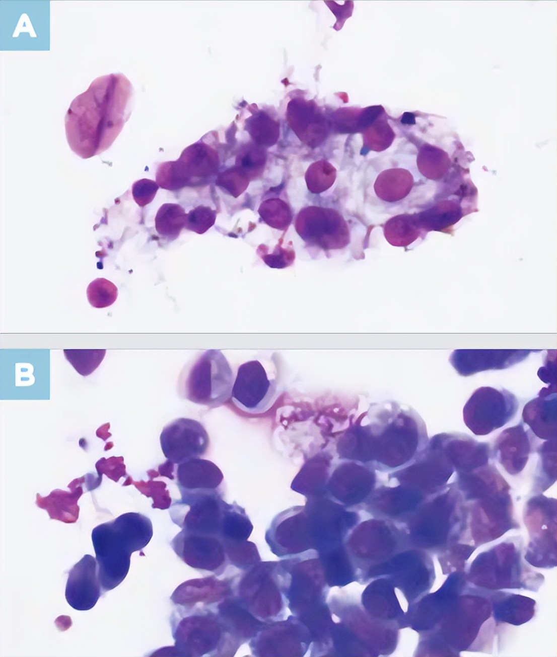 尿液干化学分析的实验原理,尿液标本采集操作