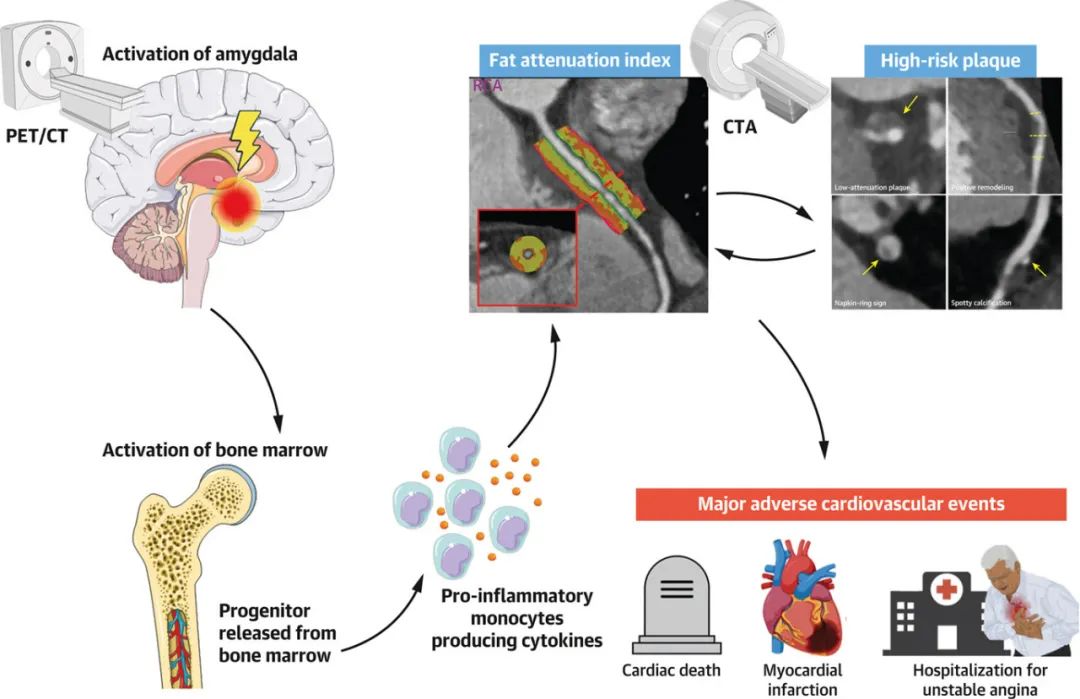 生气引起心梗的十种疾病,心梗猝死跟心情生气激动有关系吗