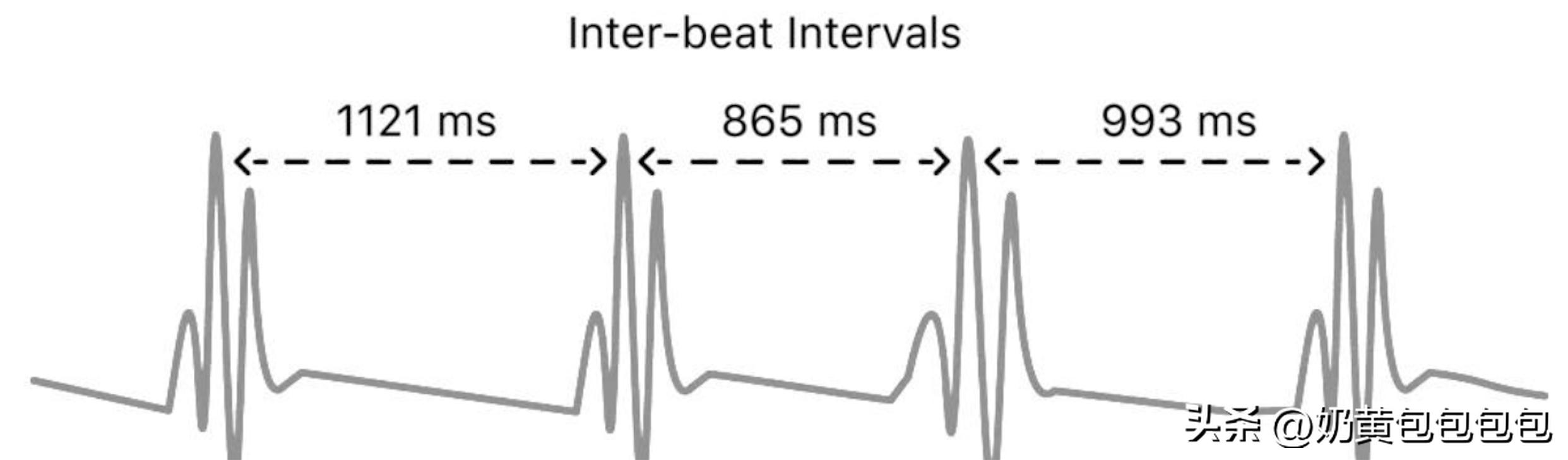 佳明forerunner255运动手表,佳明255运动手表最新款