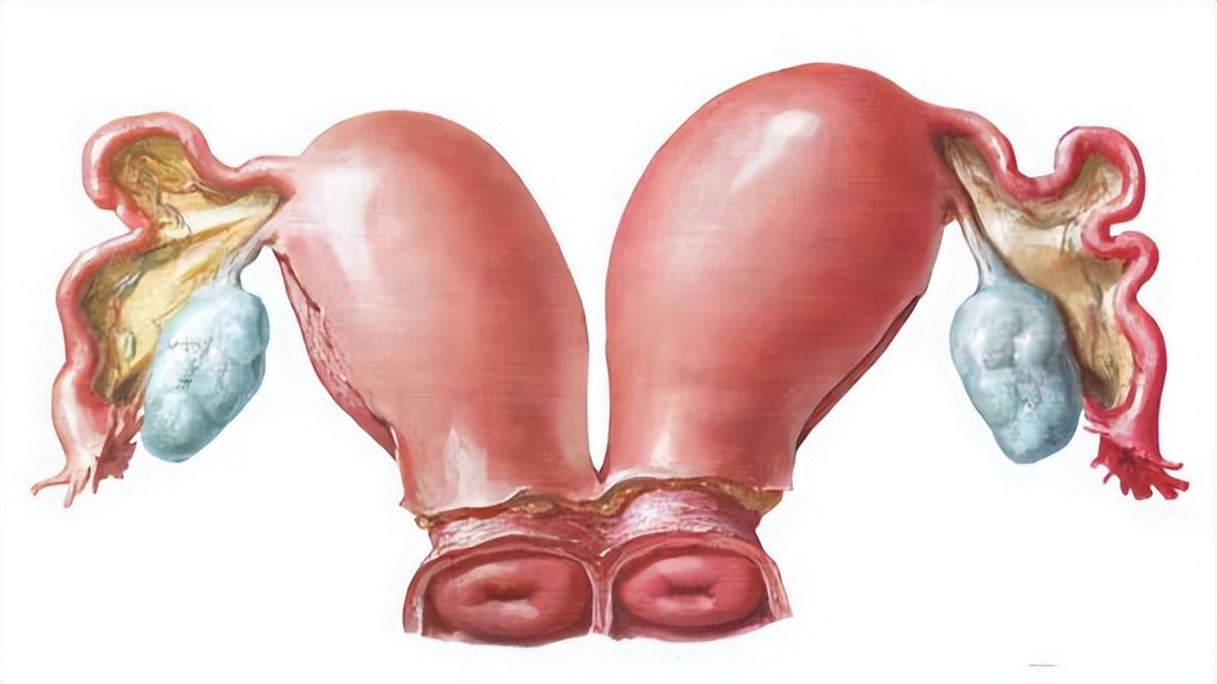 24岁女子体检发现有两个子宫,女子婚前体检却显示怀孕2个月