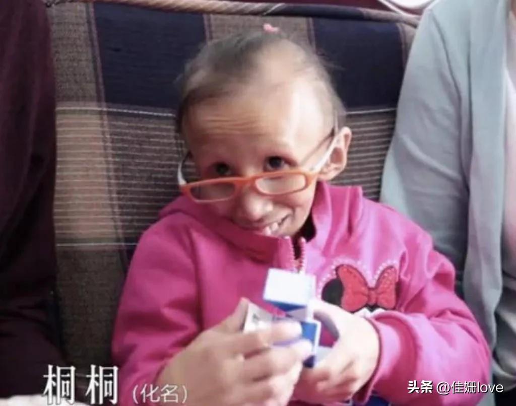 14岁女孩拥有80多岁的容貌，生命的尽头是希望妈妈生个弟弟