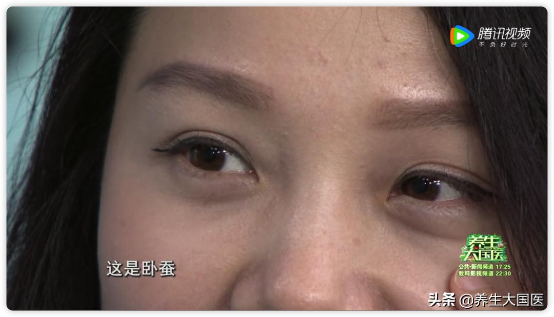 对付眼袋有良方,中年人的眼袋2分钟解决