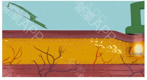 刘雯高级感,刘雯的脸型适合的风格