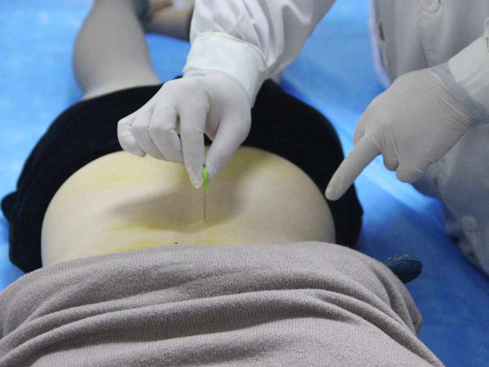 中医脚底筋膜炎如何彻底治愈,筋膜炎肩部最快的治疗方法中医