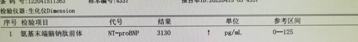 胸闷气短没在意结果查出心衰,气短胸闷突然诊断心衰