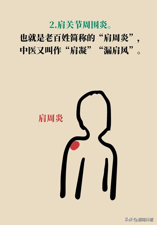 肩膀不抻不疼一抻就疼,肩膀往后伸疼