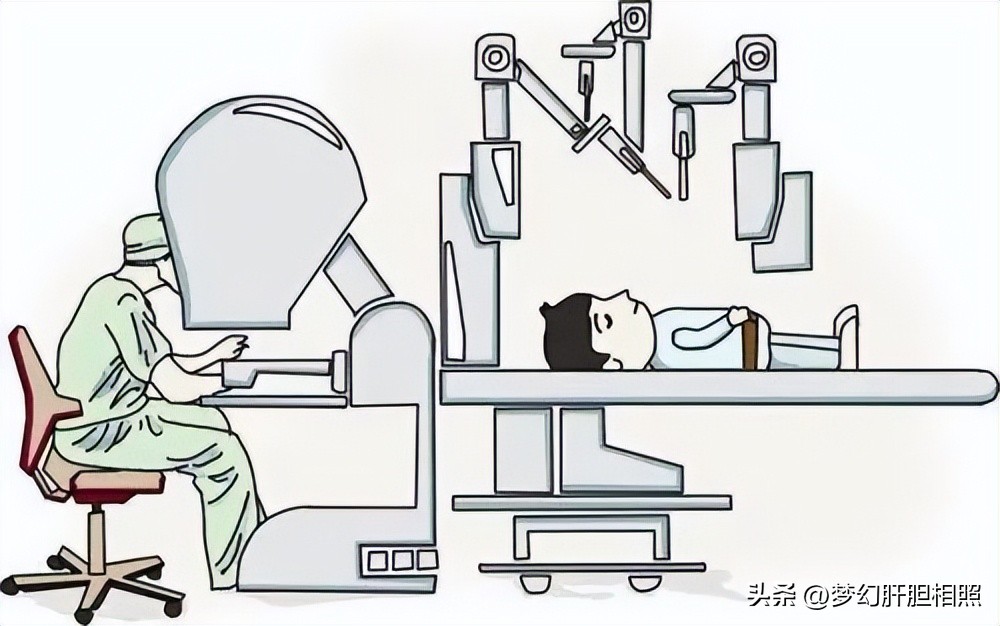 什么是微创手术机器,什么是微创手术是大手术