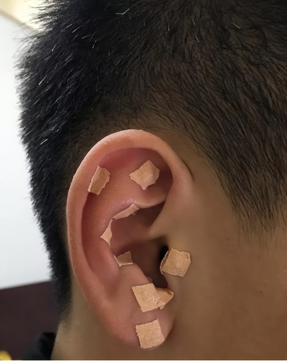 表情不受管理怎么办,表情不受控制是什么病