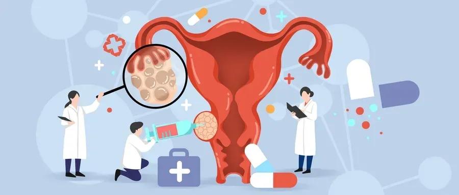 妇科内镜检查,妇科详细检查流程