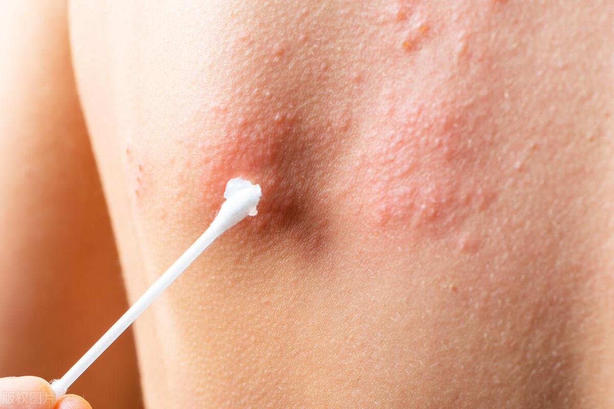 医生提醒你，这3个部位别乱亲，不然身体告诉你后果