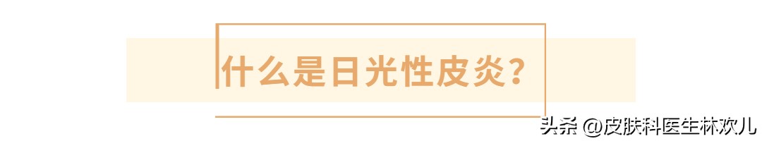 【日光性皮炎攻略】夏天想去海滩晒阳光浴？教你如何保护好自己！