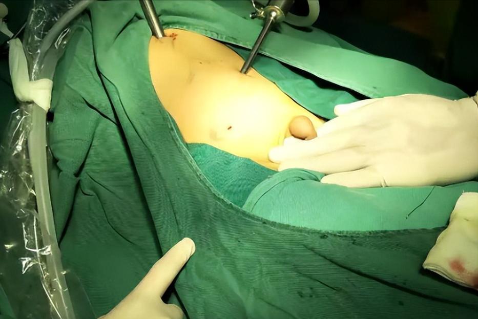 最“痛苦”手术排行榜公布,痛苦手术排行榜前十名