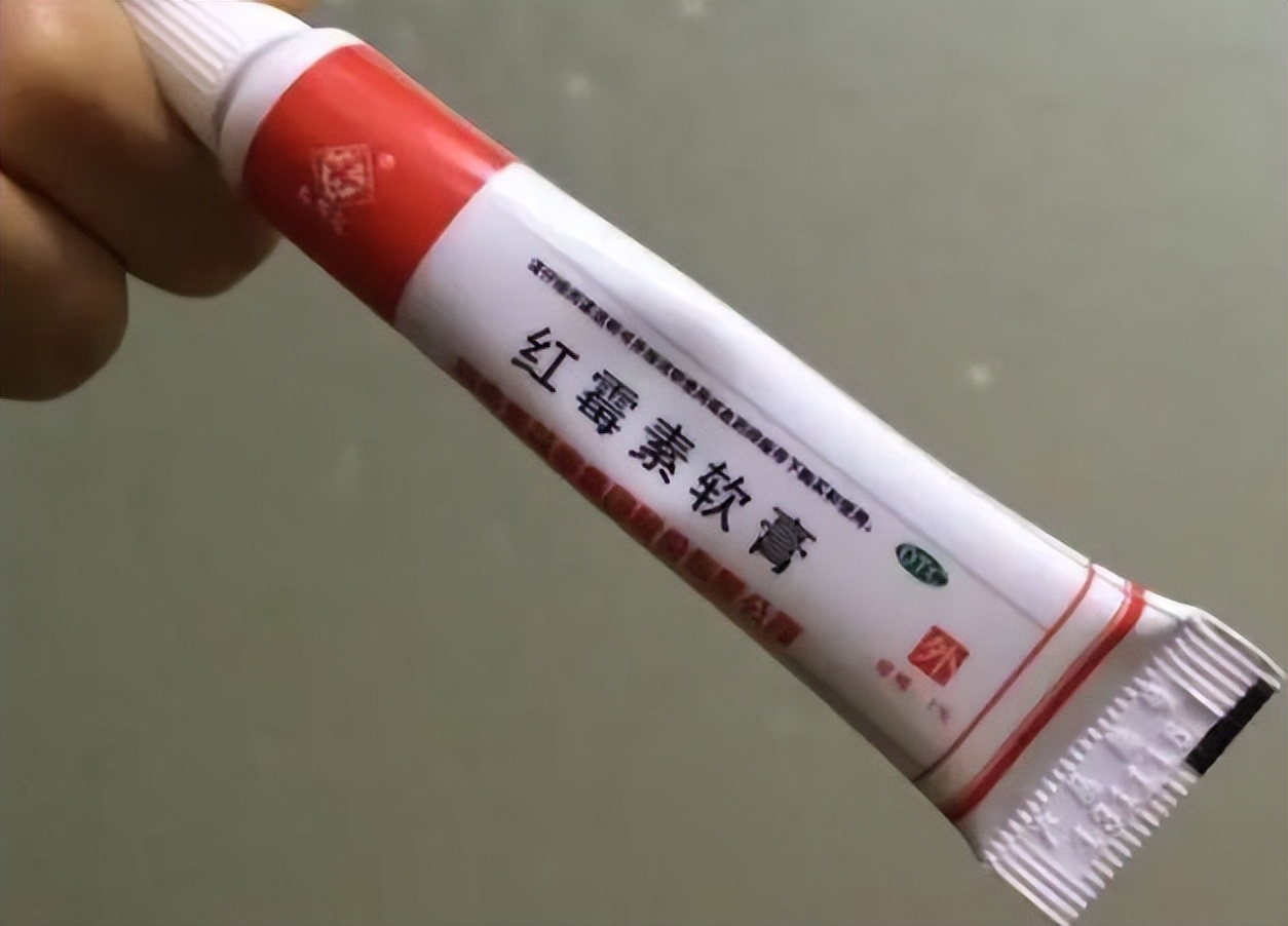 红霉素软膏真的能祛除老年斑吗,红霉素软膏去老年斑小妙招