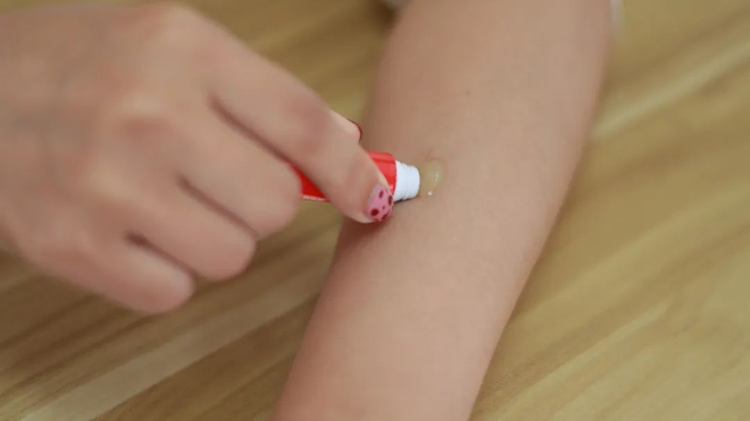 外阴白斑是外阴白色病变吗,外阴白色病变会发展为癌吗