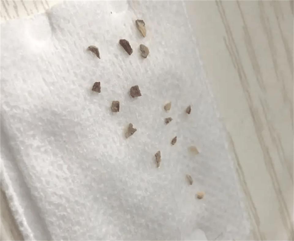 最好用的牙粉品牌排行,口碑好的牙粉推荐