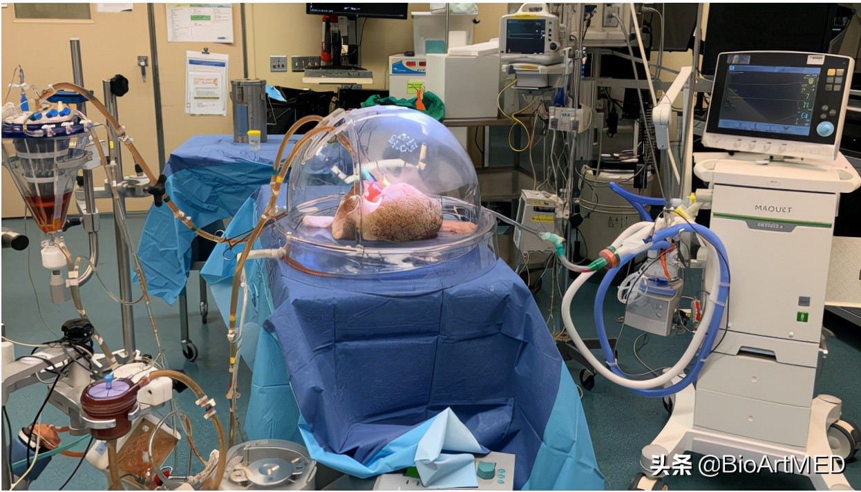 打破血型相斥的壁垒——通用血型肺移植供体是怎样诞生的？