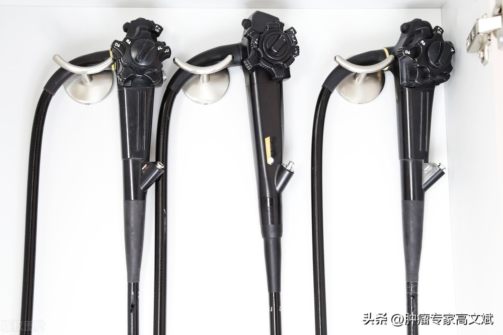 肠息肉切除后复查怎么办,肠息肉切除后怎样复查