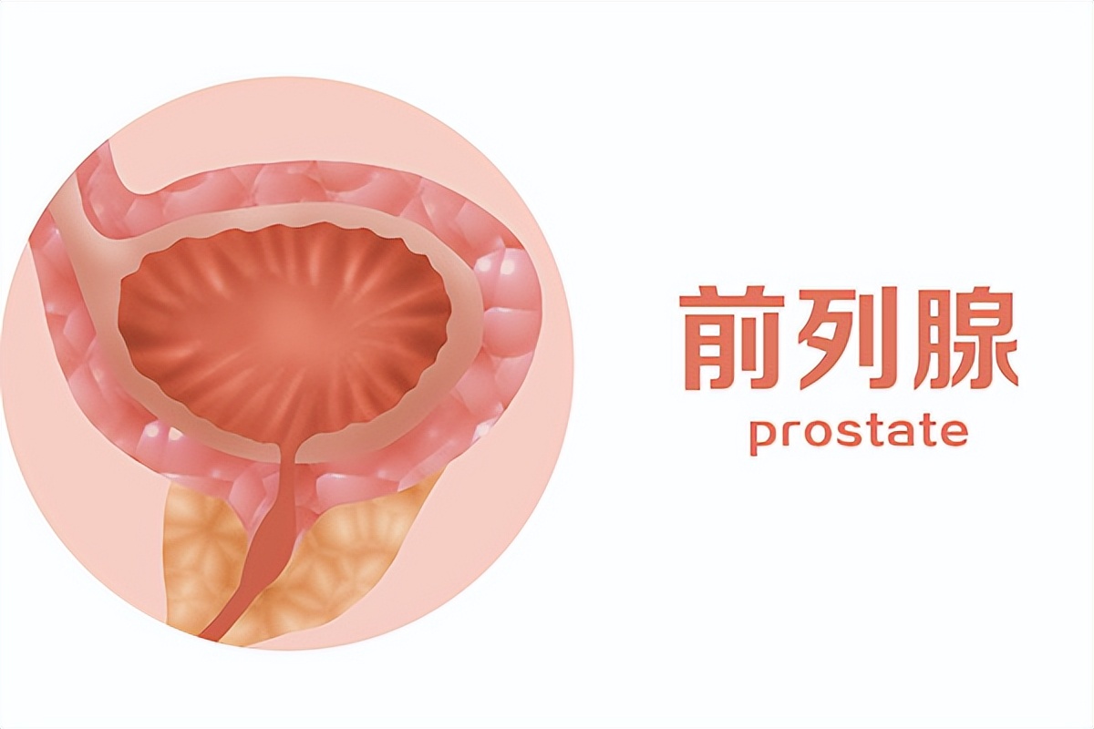前列腺疾病在生活中应该注意什么,让男人远离前列腺疾病的5条建议