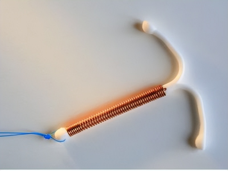 节育环在什么情况下会发生移位,节育环位置正常会引起妇科病吗