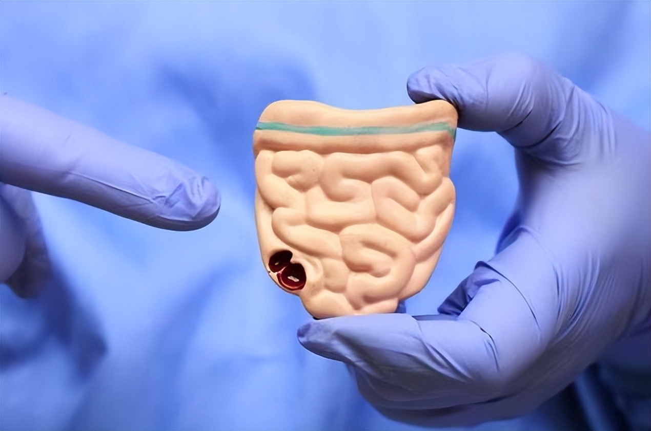 胆囊切除后遗症神经疼有办法治吗,胆囊结石切除胆囊后有什么后遗症