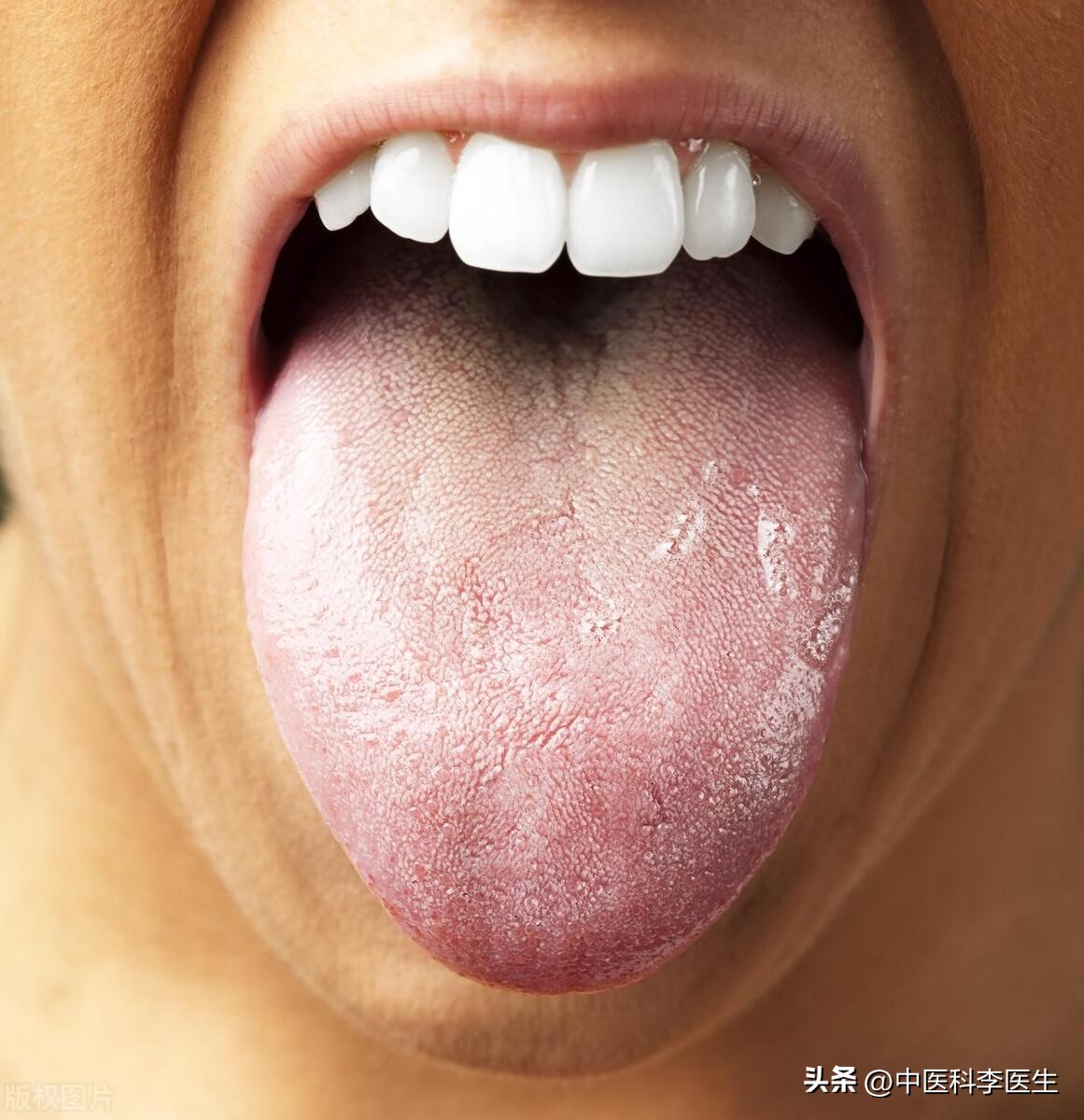 头皮和脸上起疙瘩有脓包怎么回事,头皮上长红疙瘩脓包头皮屑特别多