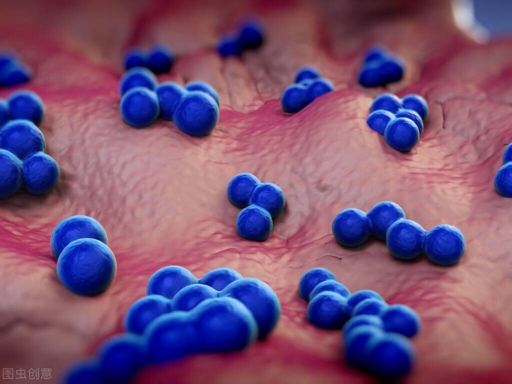 尖锐性湿疣应注意什么,尖锐性湿疣生活上要注意什么