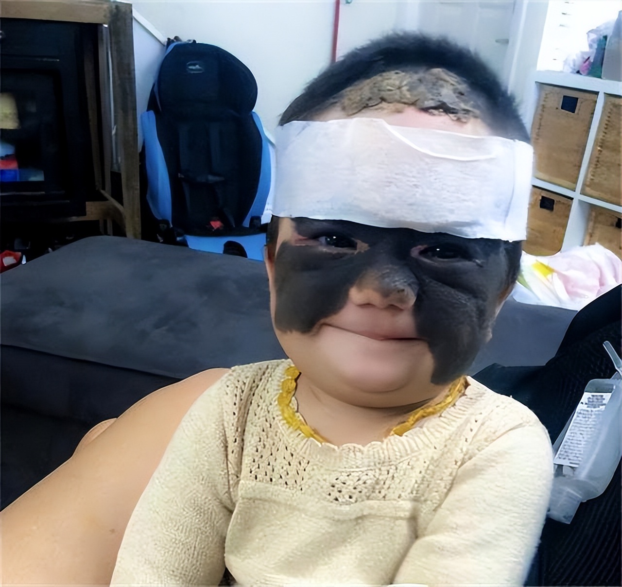 小女孩胎记后续,女童脸上长胎记去哪个医院