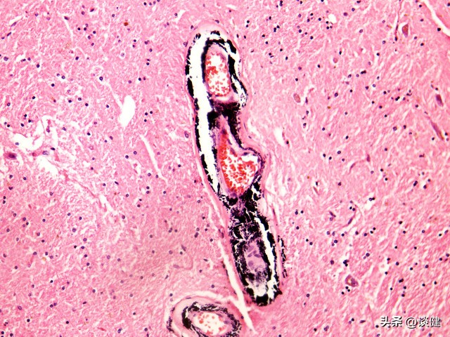 长期喝红茶能降血压吗,长期喝红茶可以降血脂吗