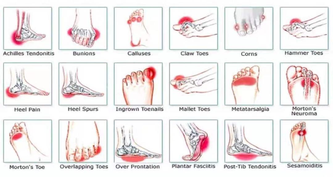 全国爱足日义诊宣传片,新时代文明实践爱心义诊