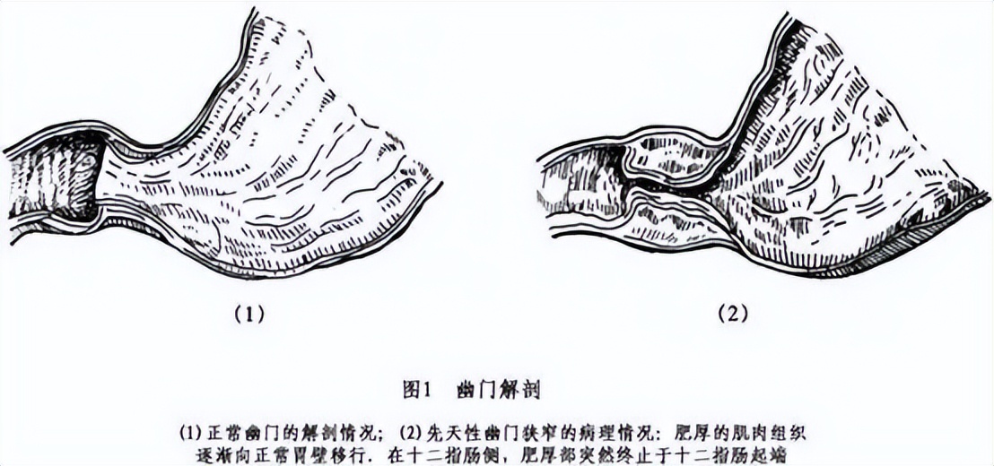 刚出生婴儿喝奶一小时后吐奶,一岁宝宝喝奶吐了晚上睡觉哭闹