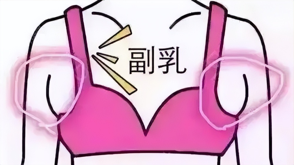 胸部重度松弛下垂,胸部重度下垂