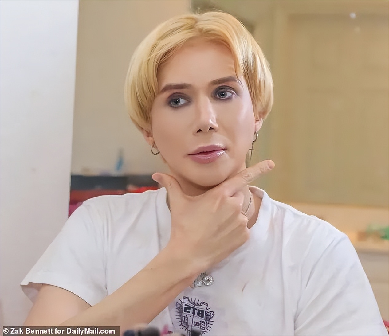 白人网红沉迷韩国流行文化，疯狂整容还做丁丁缩小术？