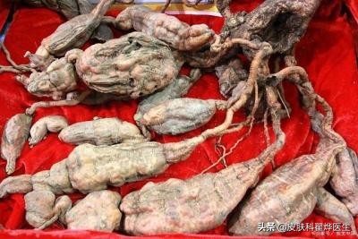 脱发族有救了？新研究：多吃这几类豆制品，可改善毛囊，防治脱发