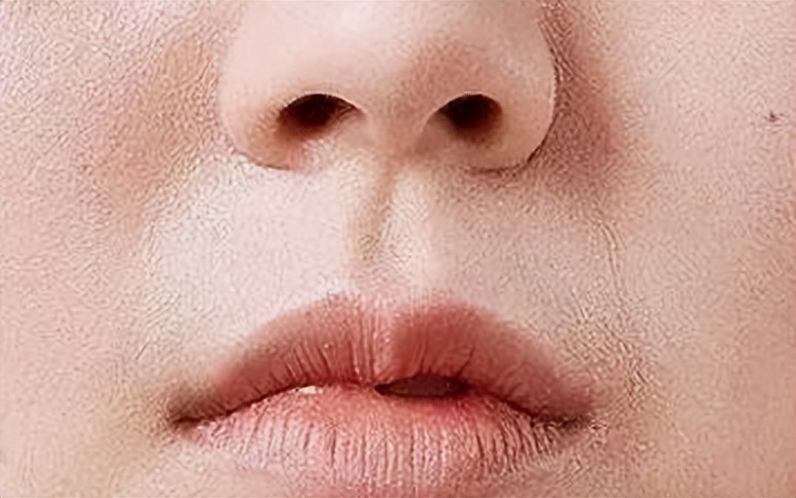 ——拿什么来拯救我的夏日底妆*水光针