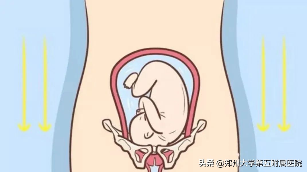 剖宫产盆底肌修复有必要做吗,剖宫产后恢复盆底肌腹直肌